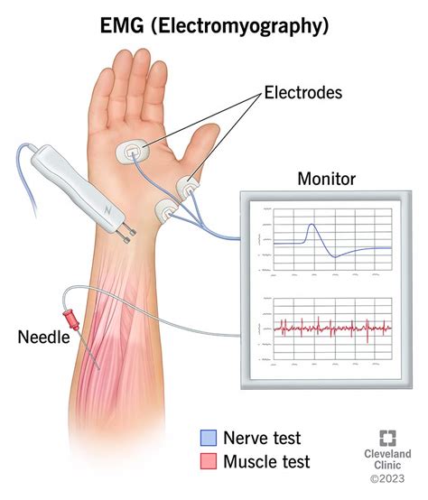 symptoms of emg testing